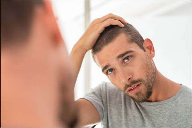 La perte de cheveux et le stress